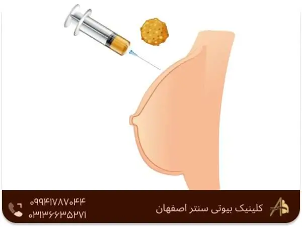 لیفت سینه با لیزر بدون درد