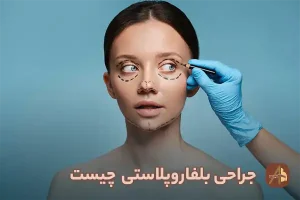 جراحی بلفاروپلاستی