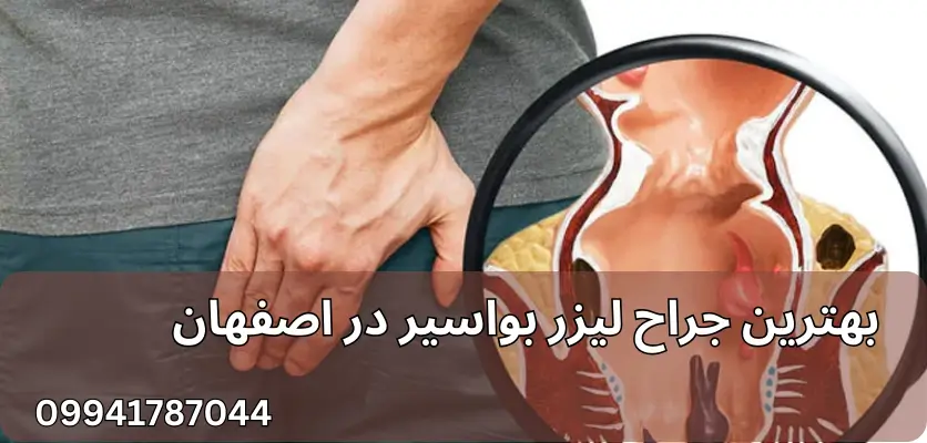 پزشکان متخصص لیزر همورئید در اصفهان: چرا به آنها اعتماد کنیم؟