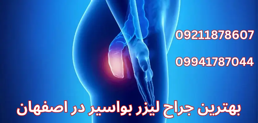 خدمات بیمه برای درمان بواسیر