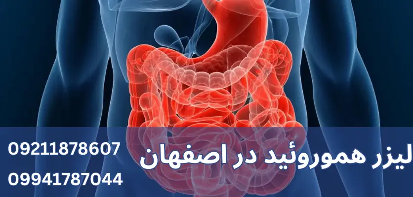 عوارض عدم درمان همورئید: چه خطراتی وجود دارد؟