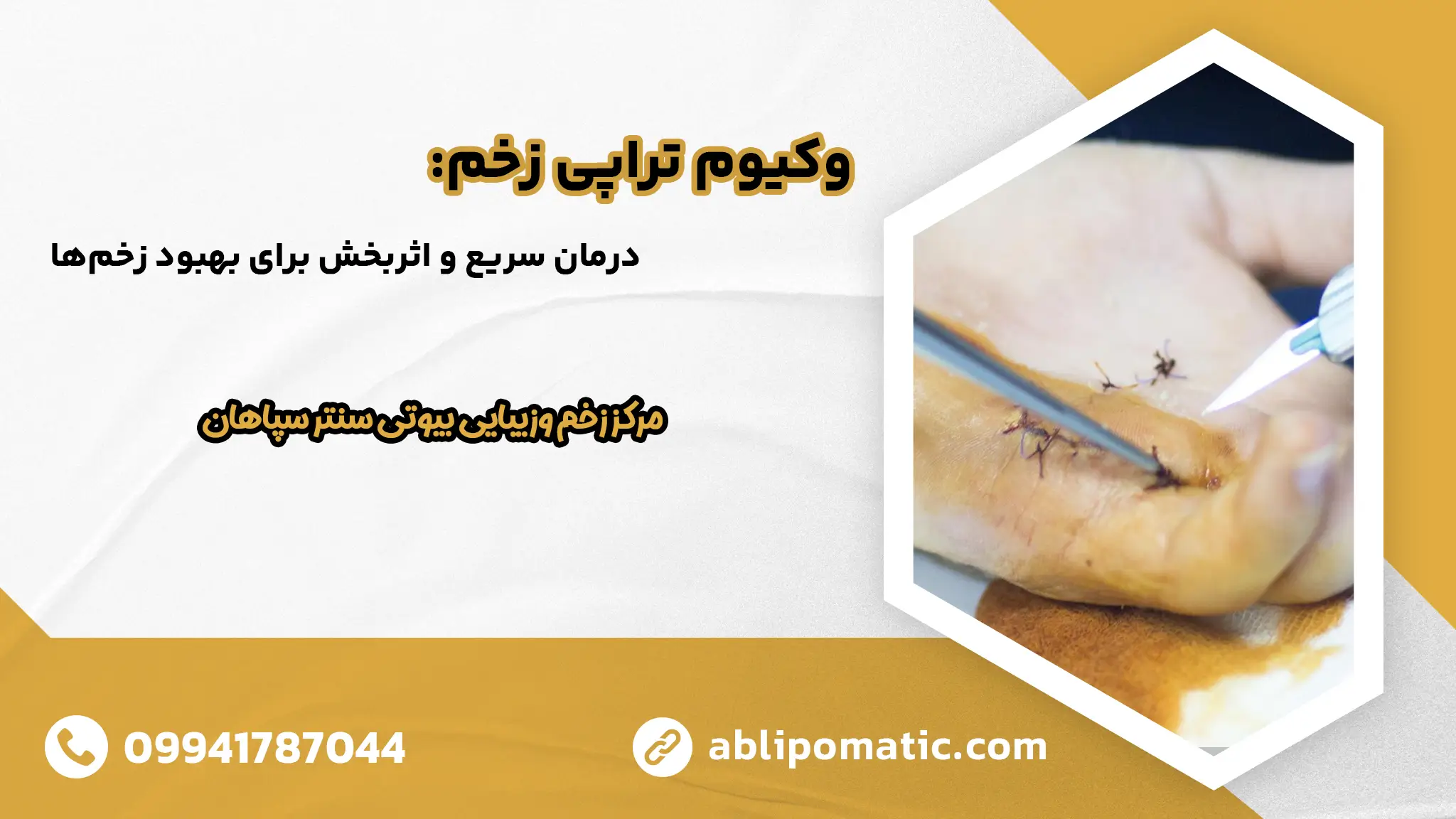 بهترین مرکز درمان زخم در اصفهان