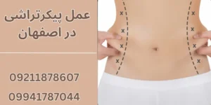 5 روش مؤثر پیکرتراشی برای از بین بردن چربی مقاوم