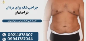 جراحی شکم برای مردان در اصفهان