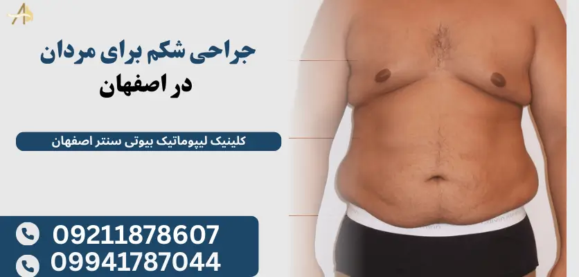 جراحی شکم برای مردان در اصفهان