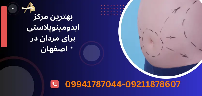 بهترین مرکز ابدومینوپلاستی برای مردان در اصفهان