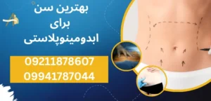 بهترین سن برای ابدومینوپلاستی