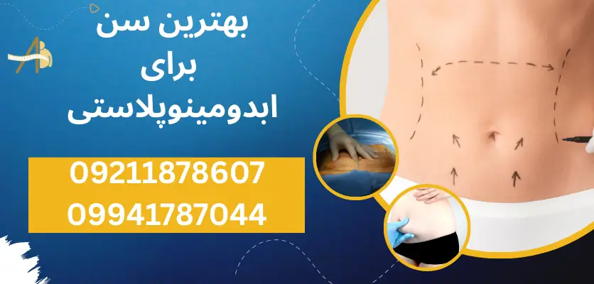 بهترین سن برای ابدومینوپلاستی