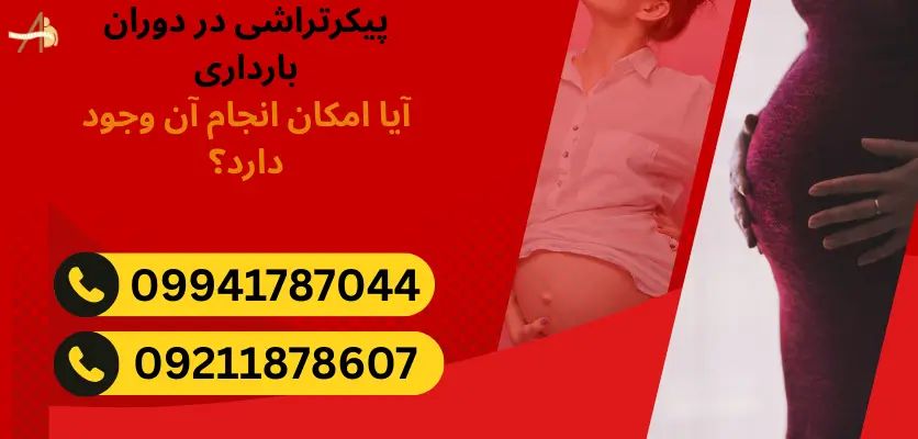 پیکر تراشی برای مادران باردار