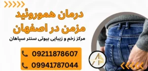 درمان هموروئید مزمن در اصفهان