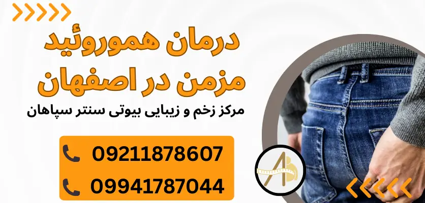 درمان هموروئید مزمن در اصفهان