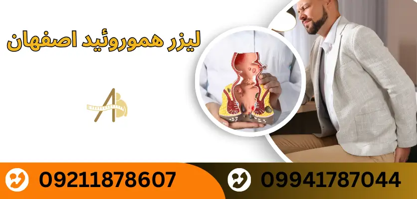 لیزر هموروئید اصفهان