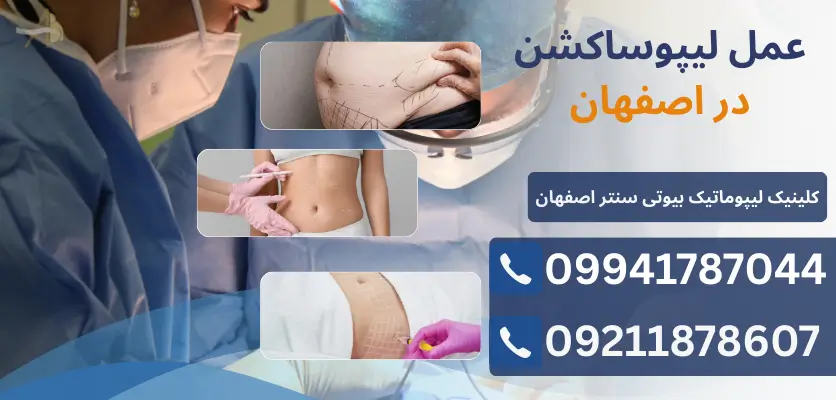 عمل لیپوساکشن در اصفهان
