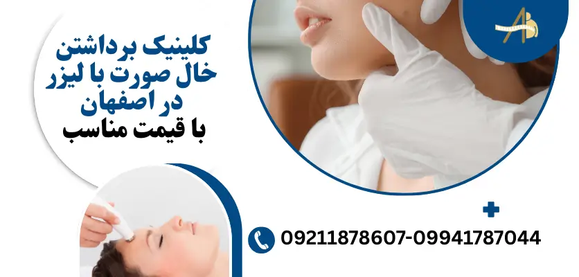 کلینیک برداشتن خال صورت با لیزر در اصفهان با قیمت مناسب