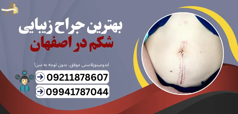 بهترین جراح زیبایی شکم در اصفهان