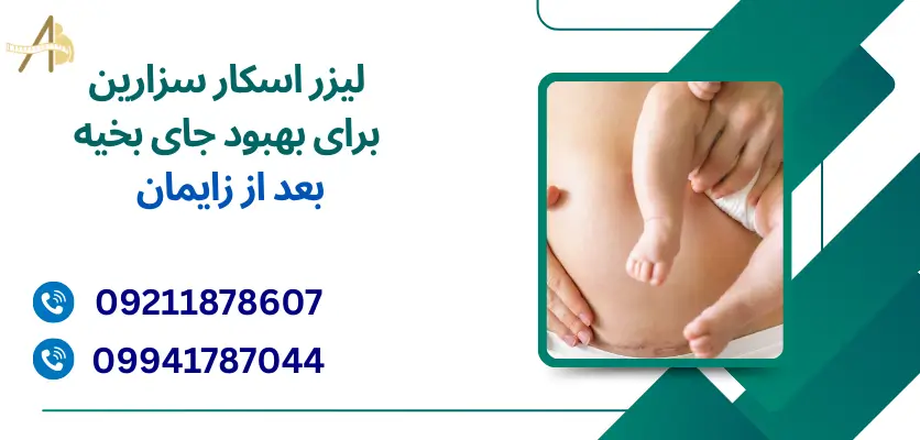 لیزر اسکار سزارین برای بهبود جای بخیه بعد از زایمان