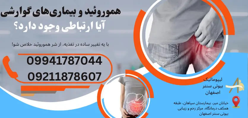هموروئید و بیماری های گوارشی