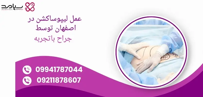 عمل لیپوساکشن در اصفهان توسط جراح باتجربه