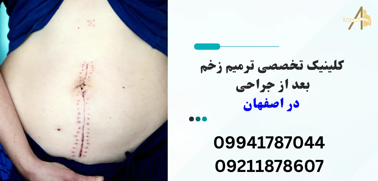کلینیک تخصصی ترمیم زخم بعد از جراحی در اصفهان