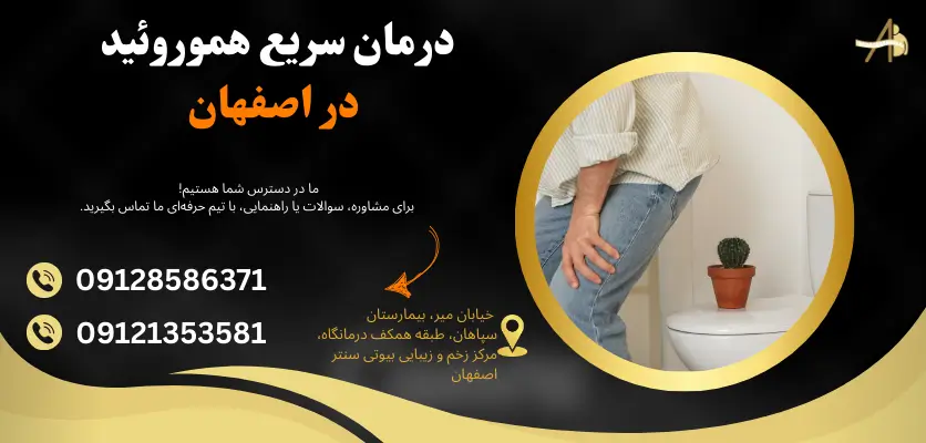 درمان سریع هموروئید در اصفهان