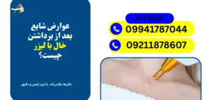 عوارض برداشتن خال با لیزر