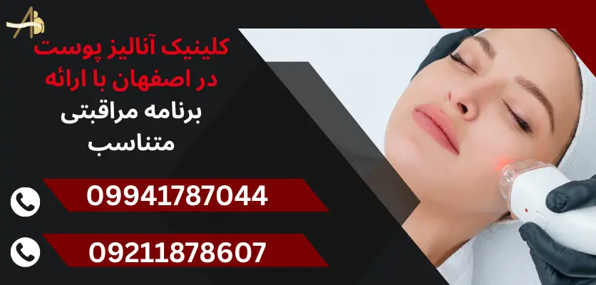 کلینیک آنالیز پوست در اصفهان با ارائه برنامه مراقبتی متناسب