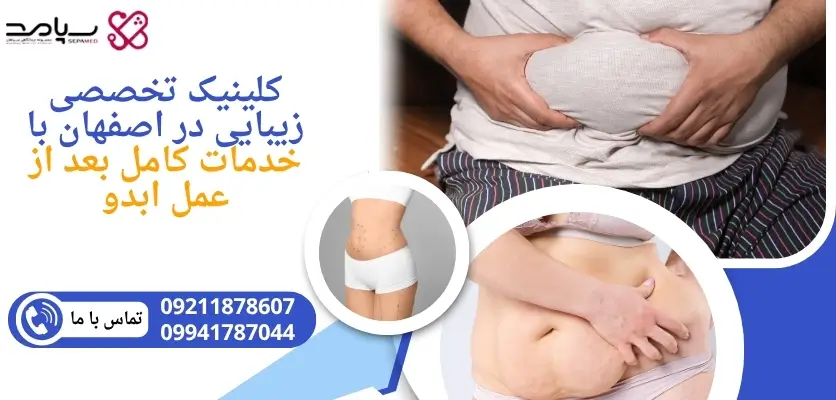 کلینیک تخصصی زیبایی در اصفهان با خدمات کامل بعد از عمل ابدو