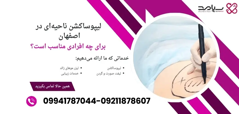 لیپوساکشن ناحیه ای در اصفهان