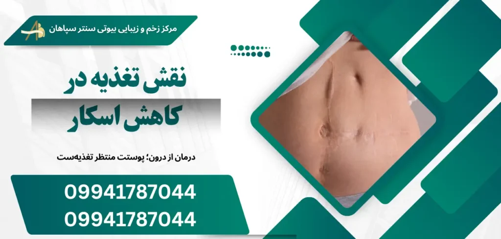 نقش تغذیه در کاهش اسکار