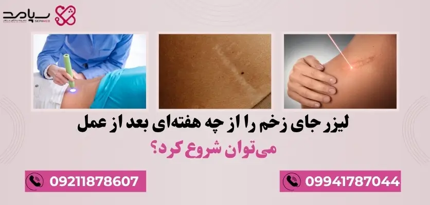بهترین زمان شروع لیزر جای زخم