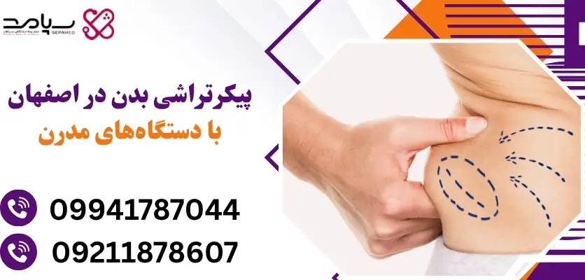 پیکرتراشی بدن در اصفهان با دستگاههای مدرن