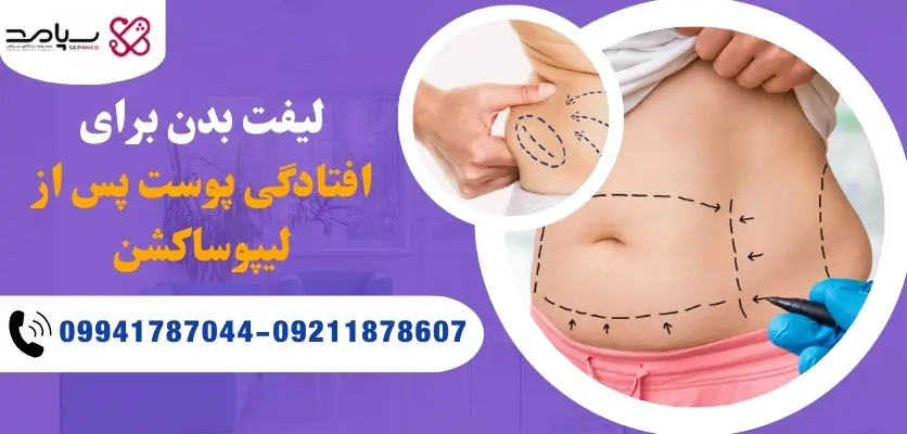 لیفت بدن پس از لیپوساکشن