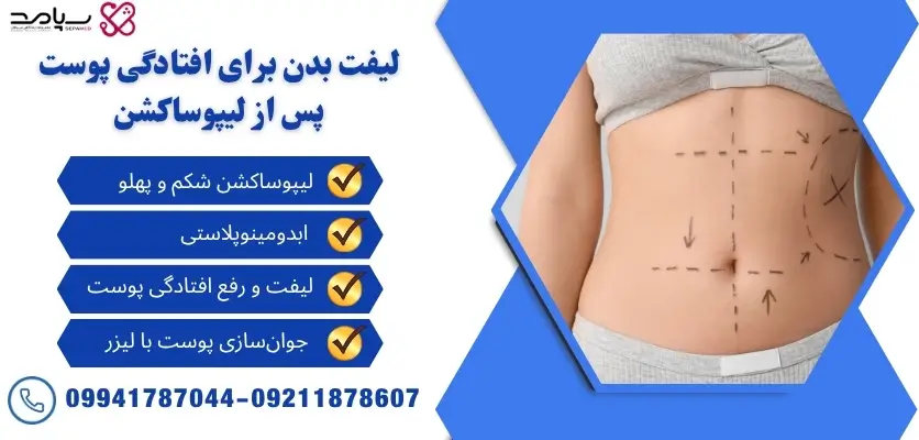 لیفت بدن بعد از لیپوساکشن