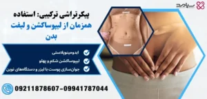 استفاده همزمان از لیپوساکشن و لیفت بدن