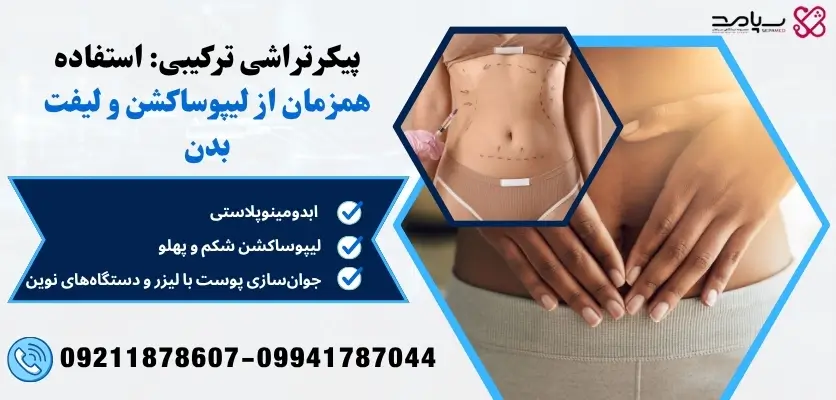 استفاده همزمان از لیپوساکشن و لیفت بدن