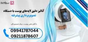 آنالیز پوست با دستگاه