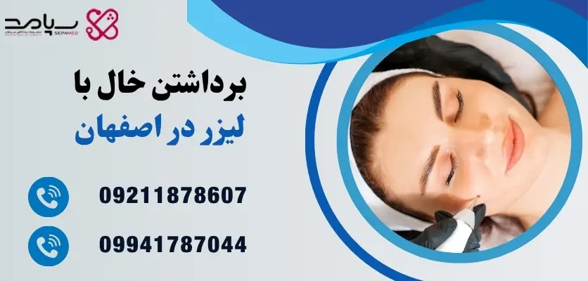 برداشتن خال با لیزر در اصفهان