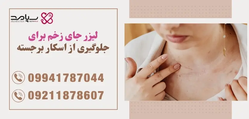 لیزر جای زخم برای جلوگیری از اسکار برجسته