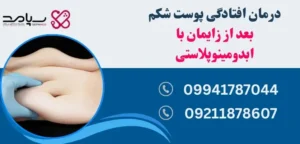 افتادگی پوست شکم بعد از زایمان