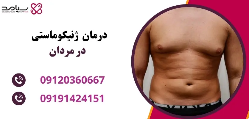 درمان چربی سینه در مردان