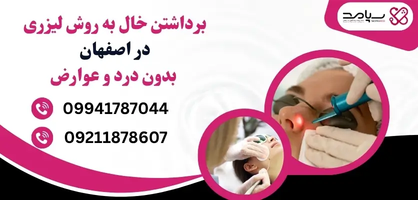 برداشتن خال به روش لیزری در اصفهان بدون درد و عوارض