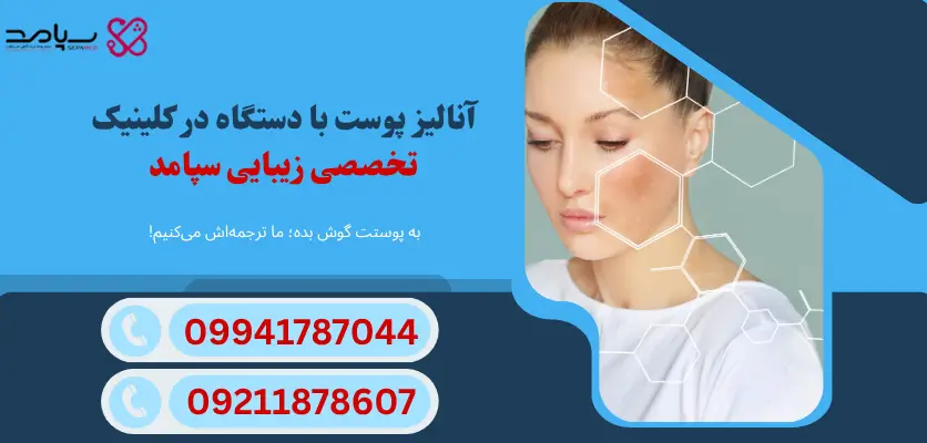 آنالیز پوست دیجیتال در کلینیک تخصصی سپامد