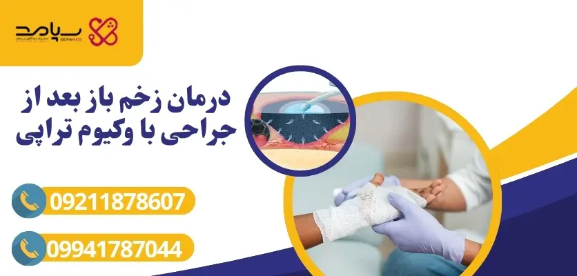 درمان زخم باز بعد از جراحی با وکیوم تراپی