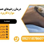 درمان زخم عمیق با وکیوم