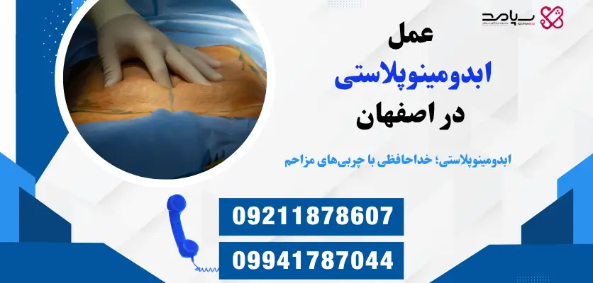 عمل ابدومینوپلاستی در اصفهان
