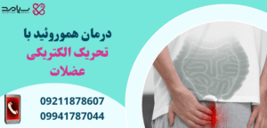درمان بواسیر با تحریک الکتریکی