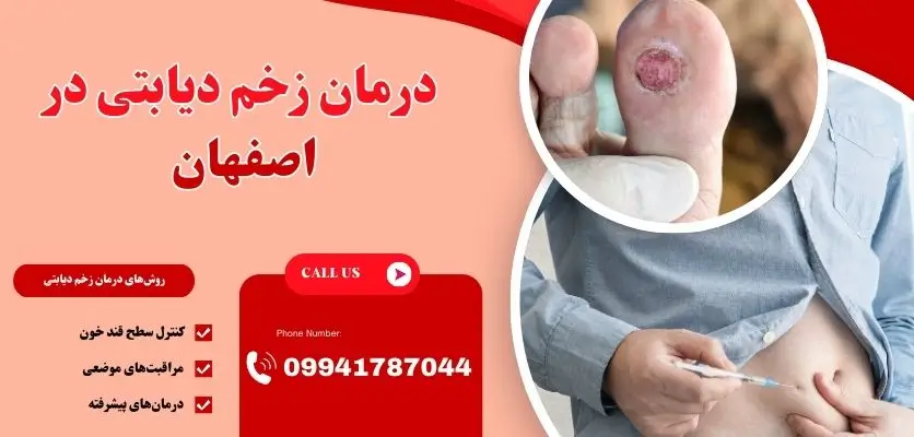 درمان زخم دیابتی در اصفهان