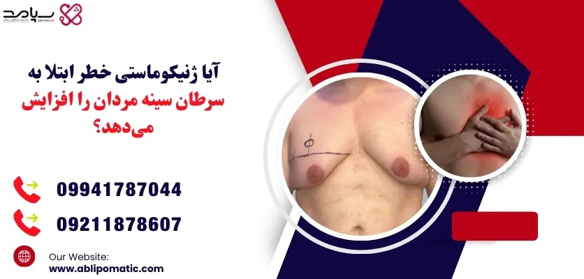 آیا ژنیکوماستی خطر ابتلا به سرطان سینه مردان را افزایش می‌دهد؟