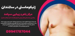 ژنیکوماستی در سالمندان