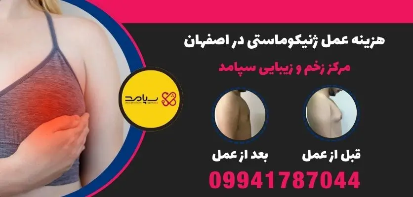 هزینه عمل ژنیکوماستی در اصفهان